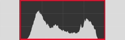 normal histogram