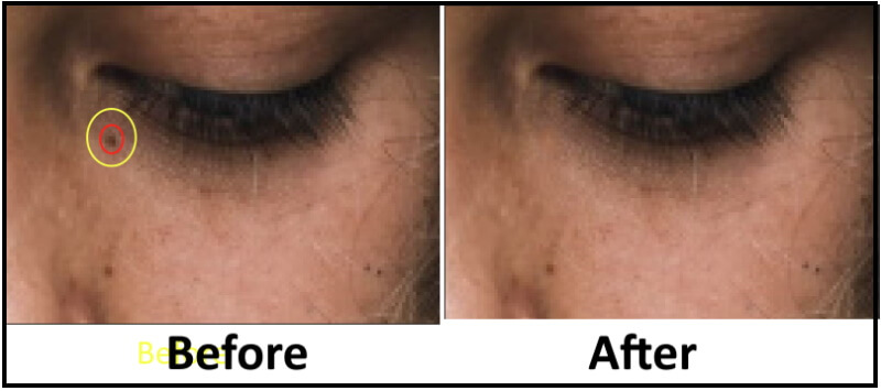 Photoshop Skin Retouching Tutorial